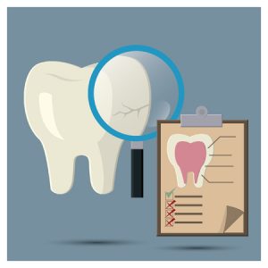 53049630 - cracked tooth checkup