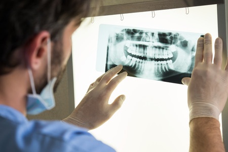 closeup of dentist looking at dental x-ray plate