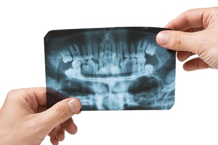 hand holds radiograph isolated on a white background